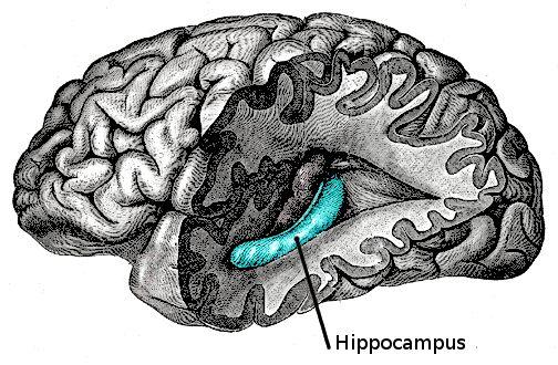 En EE.UU. implantan un dispositivo en el cerebro de un paciente con la esperanza de frenar el Alzheimer