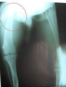 Kor, galgo en barrio marginal de Sevilla con fractura en una pata Kor, galgo en barrio marginal de Sevilla con fractura en una pata