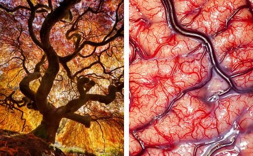 patrones arbol cerebro Patrones en la naturaleza