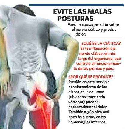 Ciática. Tratamientos naturales cuando el dolor aprieta Ciática, tratamientos naturales cuando el dolor aprieta