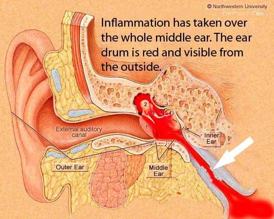 Una madre con síntomas de otitis