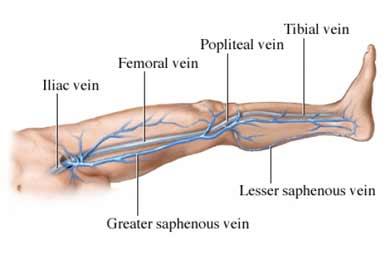 La gravedad en una arteritis de las extremidades inferiores La gravedad en una arteritis de las extremidades inferiores