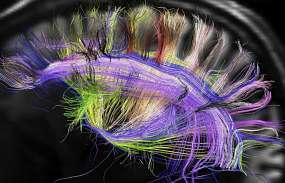 La falsa creencia de que solo usamos el 10% de nuestro cerebro Actualidad Informática. La falsa creencia de que solo usamos el 10% de nuestro cerebro. Rafael Barzanallana. UMU