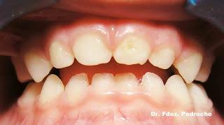 Bye, bye chupete!! Bye, bye chupete!!