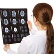 ¿Cuándo solicitar una tomografía en casos de cefalea?