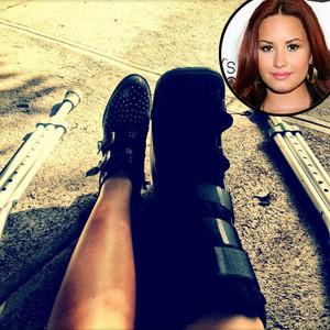 Demi Lovato muestra su pies con Moretones, y yeso: Luego del accidente sufrido