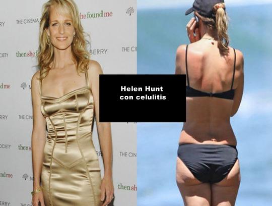 LAS CELULITIS DE 20 FAMOSAS - IMÁGENES