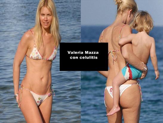 LAS CELULITIS DE 20 FAMOSAS - IMÁGENES