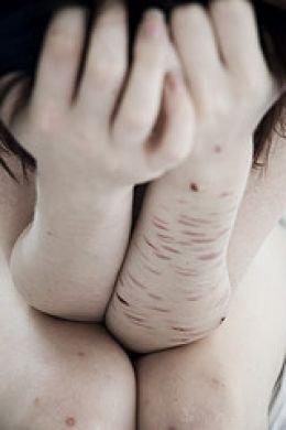 autolesion ¿CUAL ES LA RAZON PARA AUTOLESIONARSE?