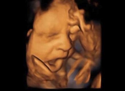 Los fetos bostezan en el vientre materno Los fetos bostezan en el vientre materno