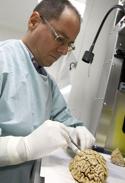 Donar el cerebro hoy para poder curar mañana Foto: Banco de Tejidos de la Fundación CIEN