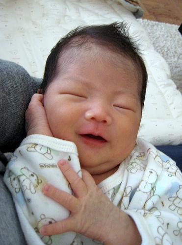 bebe-cesarea bebe-cesarea