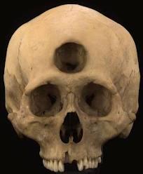 Cíclopes que hay de verdad y de mentira al respecto Cíclopes que hay de verdad y de mentira al respecto