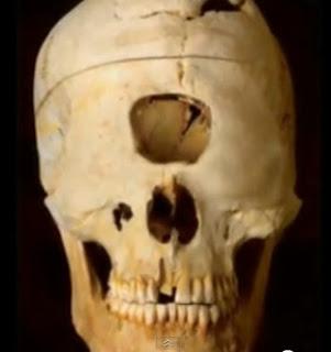 Cíclopes que hay de verdad y de mentira al respecto Cíclopes que hay de verdad y de mentira al respecto