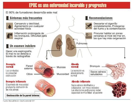 EPOC y telemedicina