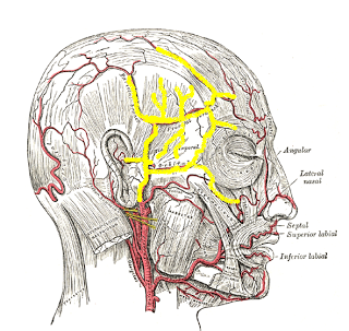 Arteritis de la Temporal, Dolor en la Sien.