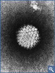El cáncer de garganta tiene mejor pronóstico si la causa es el VPH El cáncer de garganta tiene mejor pronóstico si la causa es el VPH