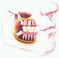 ☻Como prevenir los dientes retenidos.