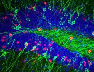 El Cerebro Funcionamiento para Recordar Cosas El Cerebro Funcionamiento para Recordar Cosas