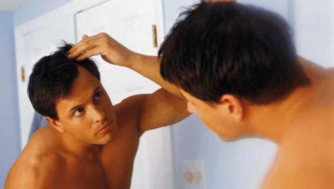 EL HOMBRE TIENE CASPA O SE LAVA MAL ? EL HOMBRE TIENE CASPA O SE LAVA MAL ?