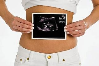 Pielocaliectasia renal del feto en ecografía prenatal