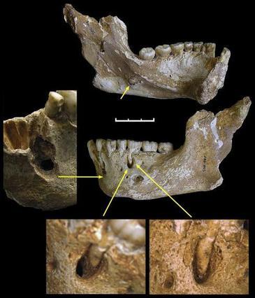 Los neandertales de El Sidrón eran diestros