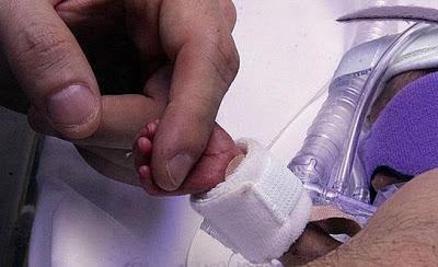 MUJER ALCOHÓLICA DA A LUZ A BEBE CON 4,5 GRAMOS DE ALCOHOL EN SANGRE MUJER ALCOHÓLICA DA A LUZ A BEBE CON 4,5 GRAMOS DE ALCOHOL EN SANGRE