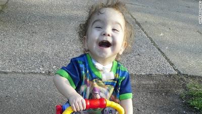 UNA IMPRESORA 3D SALVA LA VIDA DE UN BEBÉ UNA IMPRESORA 3D SALVA LA VIDA DE UN BEBÉ