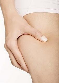 La lucha contra la celulitis La lucha contra la celulitis