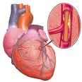 Caduet® reduce significativamente el riesgo de enfermedad coronaria calculado a 10 años