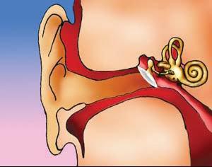 ¿Por que duelen los oídos?