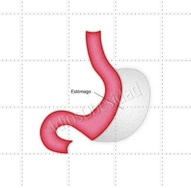 INFLUENCIA DE LA OBESIDAD EN EL CONTROLAR LA DIABETES NATURALMENTE