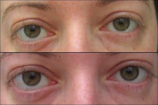 ¡Recomendables!: Protector Kodigo4 & Xlash ¡Recomendables!: Protector Kodigo4 & Xlash