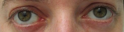 ¡Recomendables!: Protector Kodigo4 & Xlash ¡Recomendables!: Protector Kodigo4 & Xlash