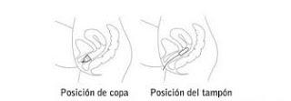 La copa menstrual