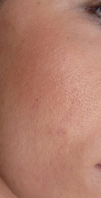 La crema la defensa de las pecas