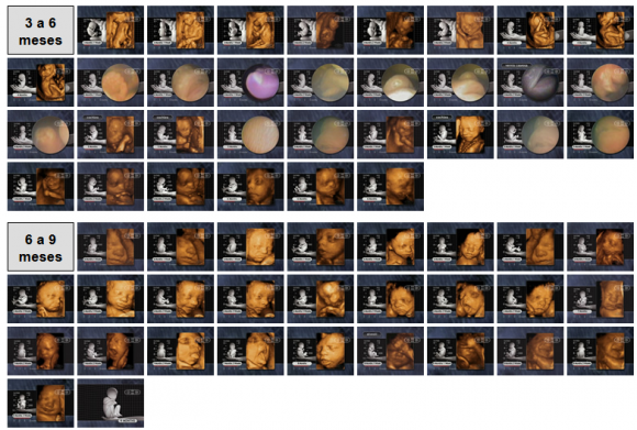 Fases del desarrollo embrionario durante el embarazo- de 3 a 9 meses Imágenes del desarrollo del embrión durante el embarazo