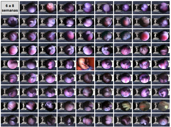 Fases del desarrollo del embrión durante el embarazo - Semanas 6 a 8 Imágenes del desarrollo del embrión durante el embarazo