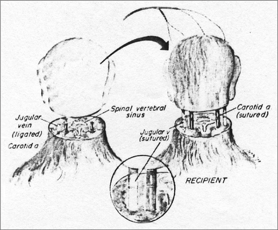 El neurocientifico que cree que el trasplante de cabeza es posible cirugia-mono