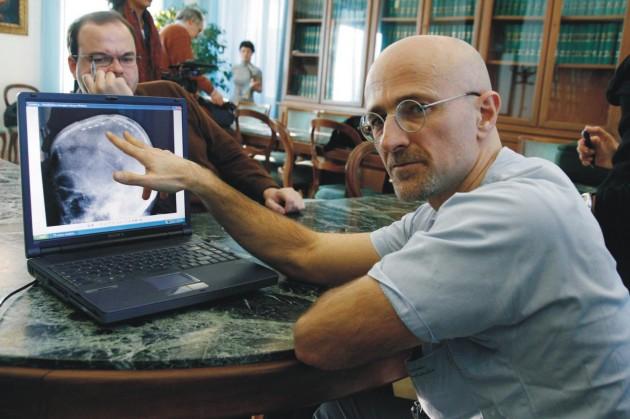 El neurocientifico que cree que el trasplante de cabeza es posible El neurocientifico que cree que el trasplante de cabeza es posible