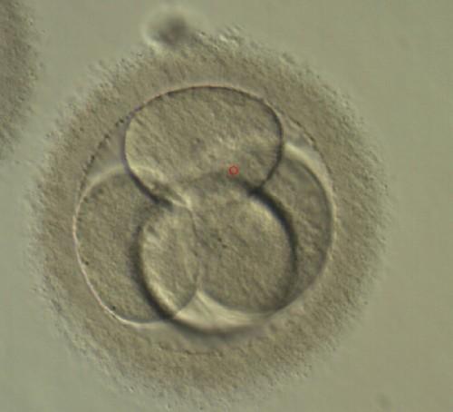 La revolución de la selección de embriones por FIV Técnicas de reproducción asistida