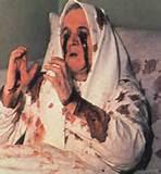 Los estigmas: ¿un ejemplo de sugestión llevada al extremo? Los estigmas: ¿un ejemplo de sugestión llevada al extremo?