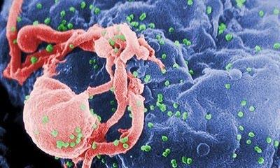 Crean células resistentes al HIV