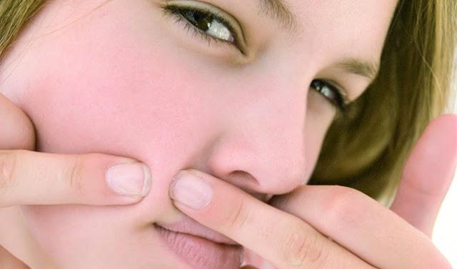 MAQUILLAJE PARA DISIMULAR EL ACNE MAQUILLAJE PARA DISIMULAR EL ACNE