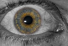 Anatomía: la úvea Anatomía: la úvea