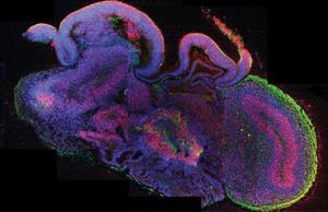 Sección de un 'organoide cerebral' con regiones diferenciadas. En rojo se observan células madre neuronales y en verde, neuronas. / Madeline A. Lancaster