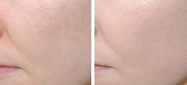 ¿ QUE ES UNA BB CREAM ? ¿ QUE ES UNA BB CREAM ?