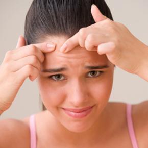 Es posible atenuar las cicatrices del acné