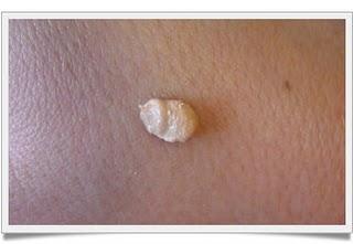 PORES NO MORE DE DR. BRANDT. PORES NO MORE DE DR. BRANDT.