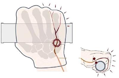 Cuando nos pasamos horashaciendo clicismo o con la mountain bike, nuestro cuerpo se ve forzado, a mantener una misma postura. Esto puede llevar a que se produzca dolor en las manos y molestias en zonas específicas del cuerpo dolor-en-los-dedos-de-las-manos-en-la-bici